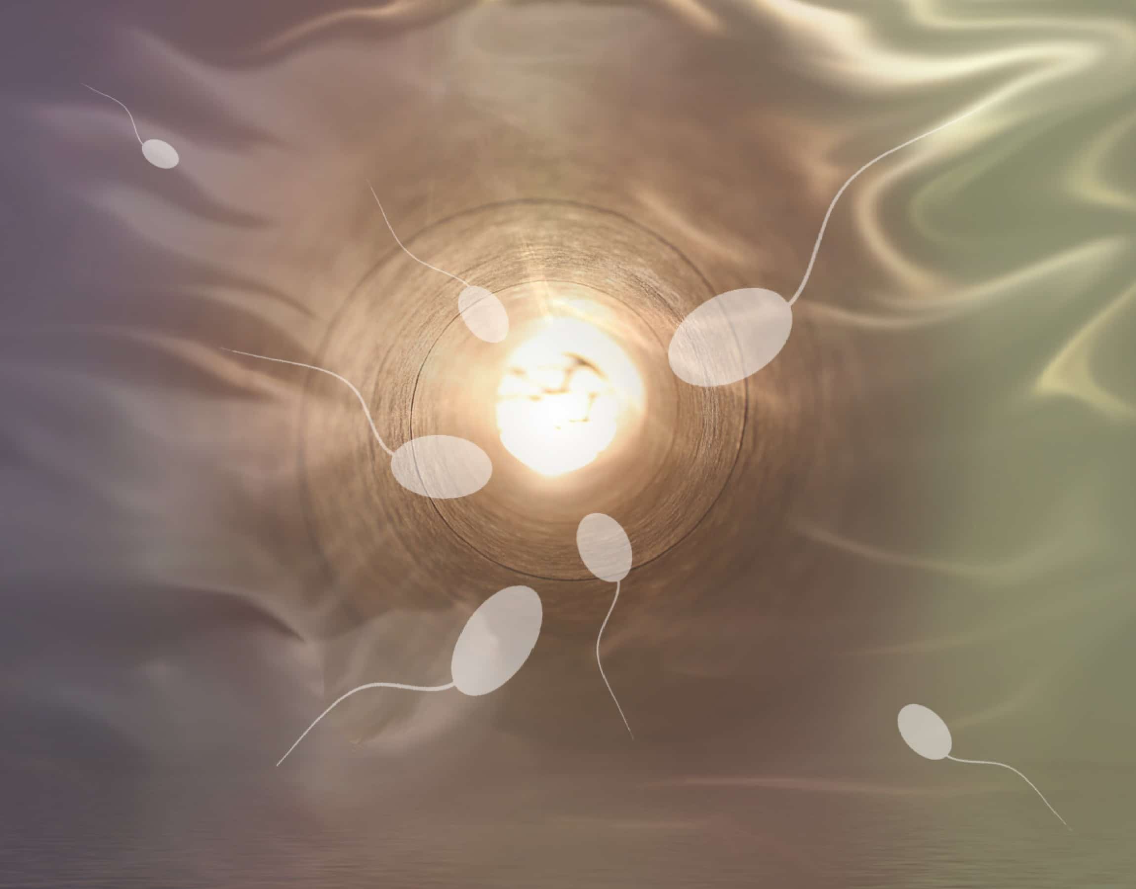 l carnitine varicocele Causes & Treament of Varicocele main image 1